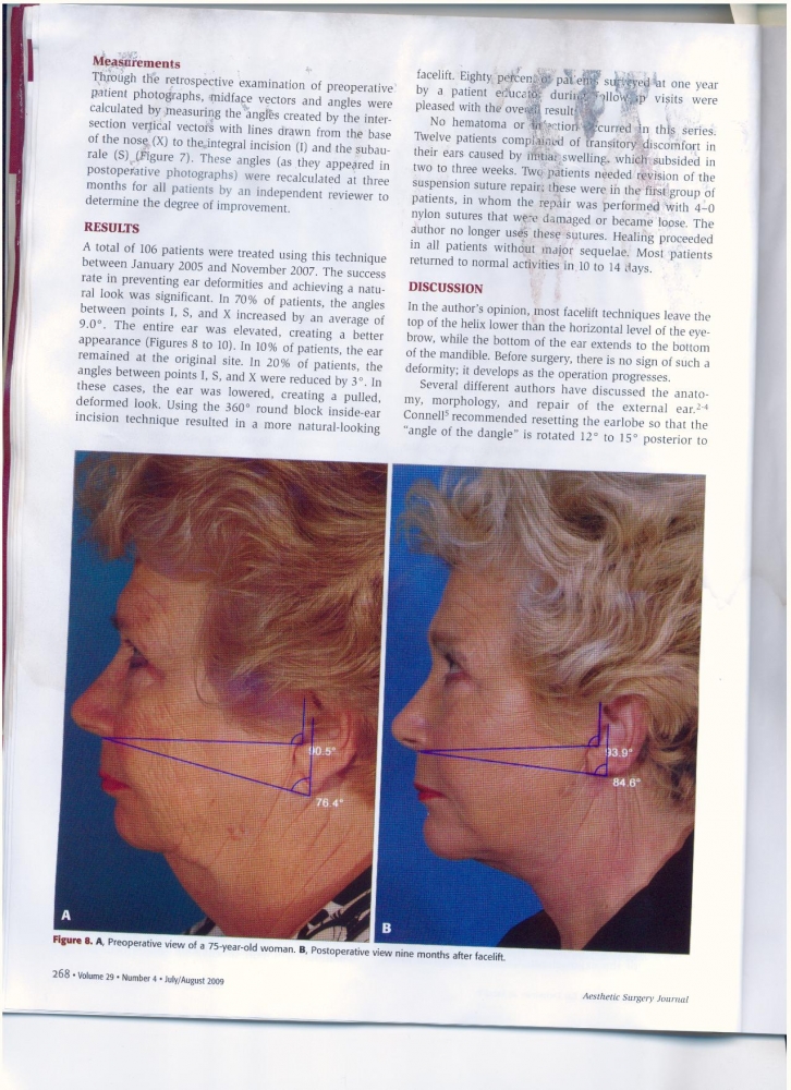 Aesthetic Surgery Journal Volume 29 Issue 4 July -August 2009