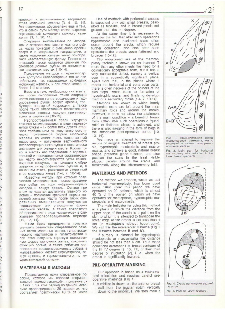 HERALD №2/2001 Горизонт. Маммапластика HERALD №2/2001 Горизонт. Маммапластика