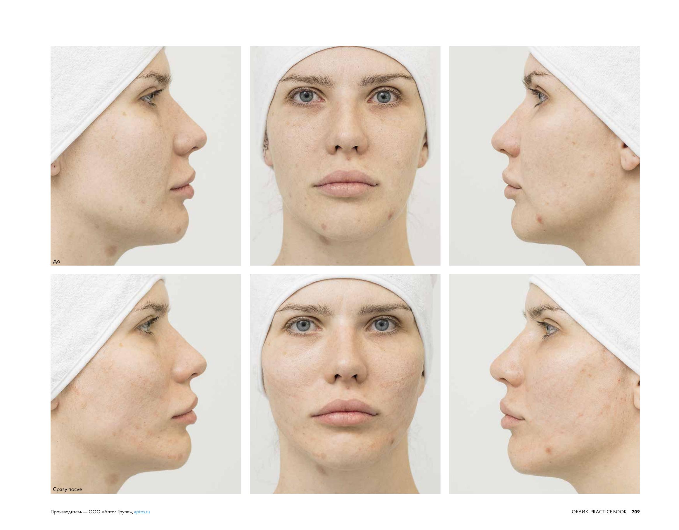 Облик_Aptos file-5.jpg