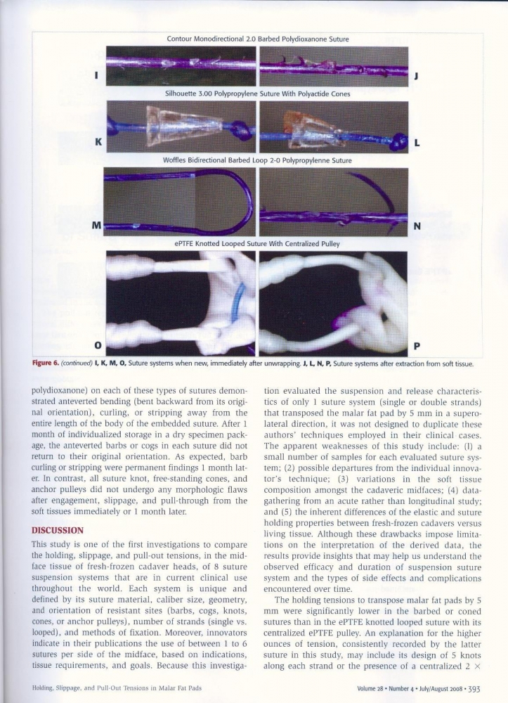 Aesthetic Surgery Journal Volume 28, Issue 4, Jul 2008 Aesthetic Surgery Journal Volume 28, Issue 4, Jul 2008