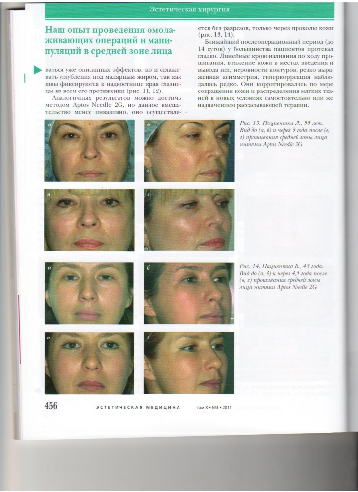 Эстетическая медицина 10-3-2011 Эстетическая медицина 10-3-2011