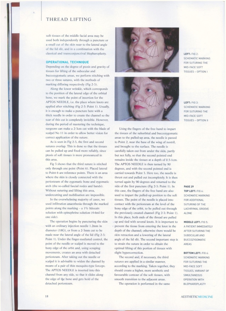 Aesthetic Medicine nov 2006
