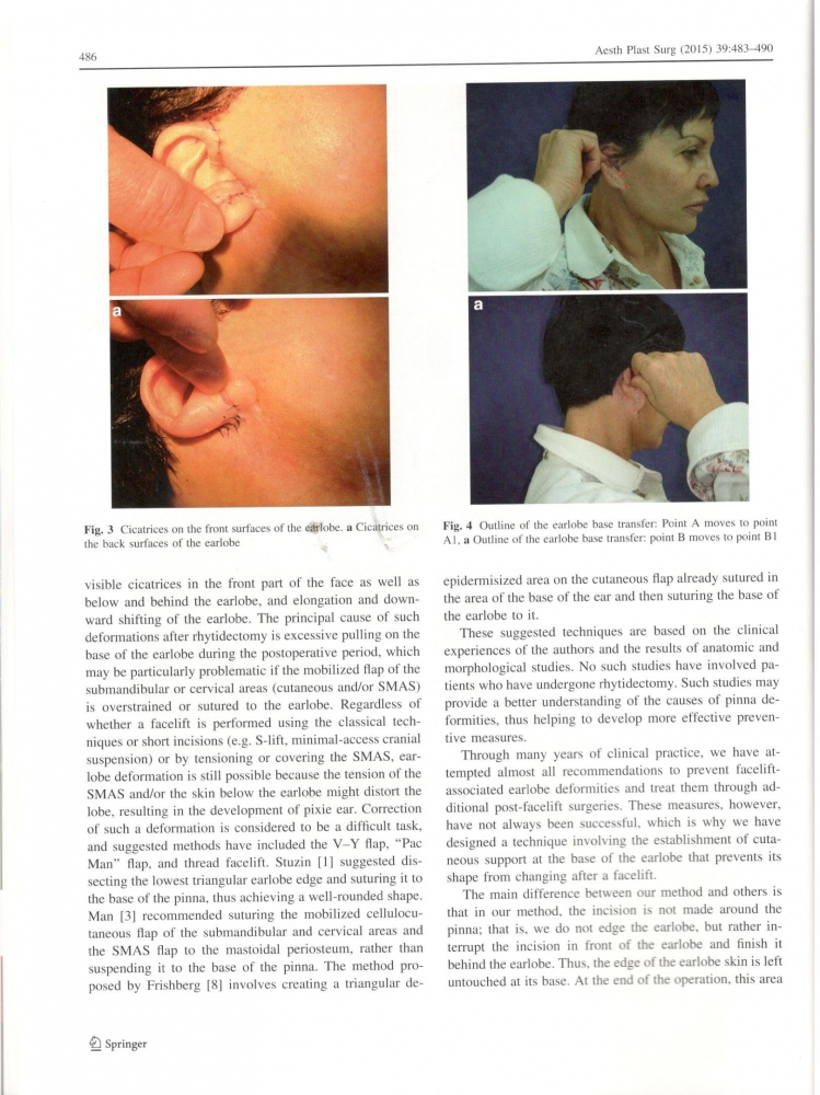 Aesthetic Plastic Surgery 39-4-Aug 2015 Aesthetic Plastic Surgery 39-4-Aug 2015