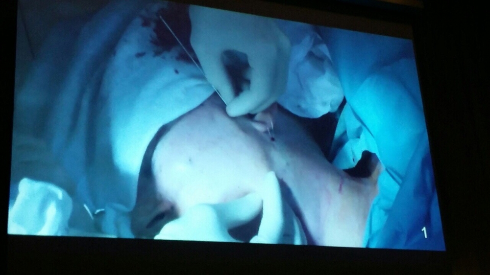 APTOS в Санкт-Петербурге: онлайн-операции по омоложению лица APTOS в Санкт-Петербурге: онлайн-операции по омоложению лица