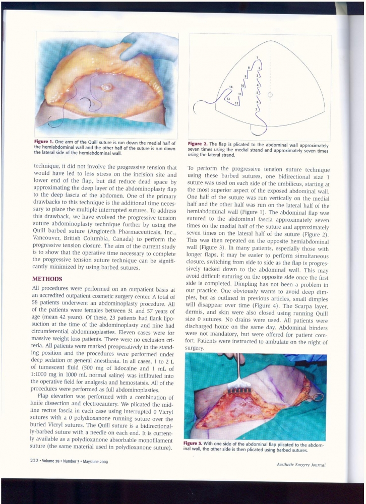 Aesthetic Surgery Journal Volume 29, Issue 3, May 2009