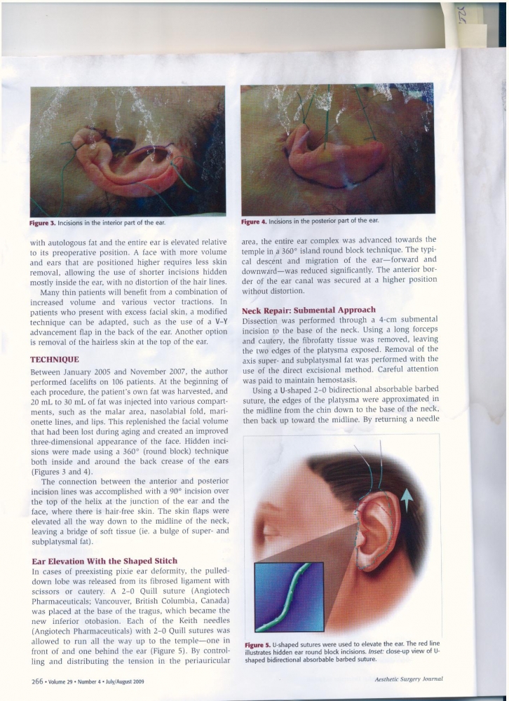 Aesthetic Surgery Journal Volume 29 Issue 4 July -August 2009