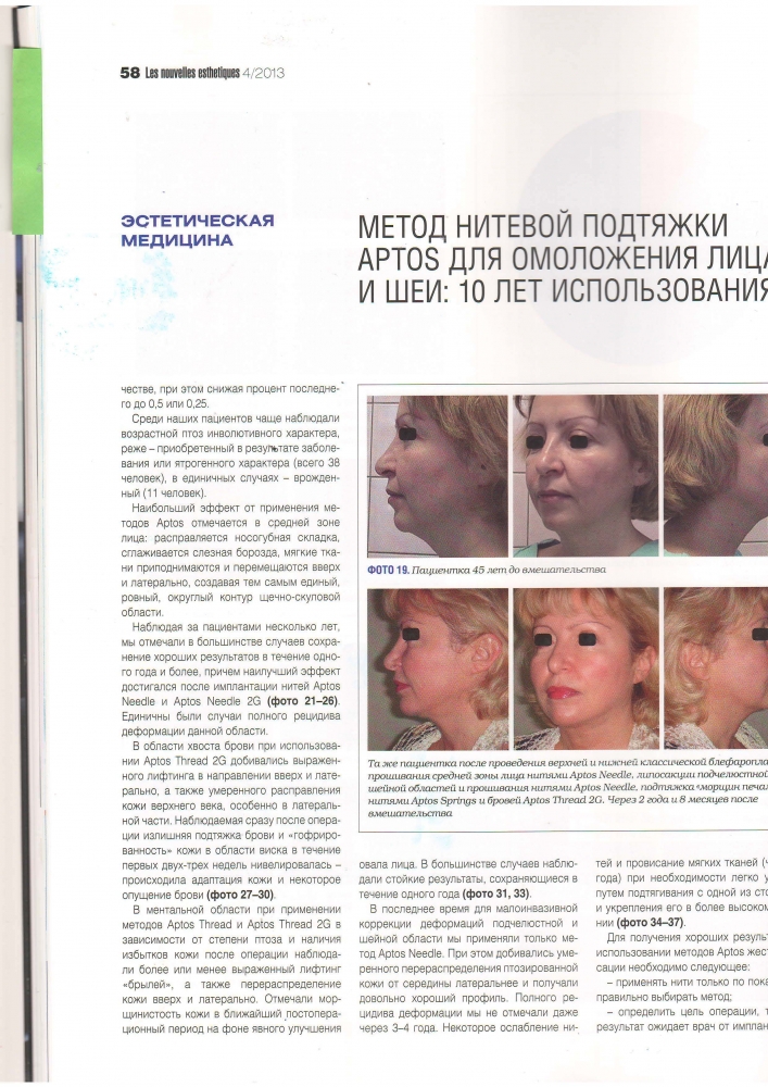 Нувель Эстетик Нувель Эстетик