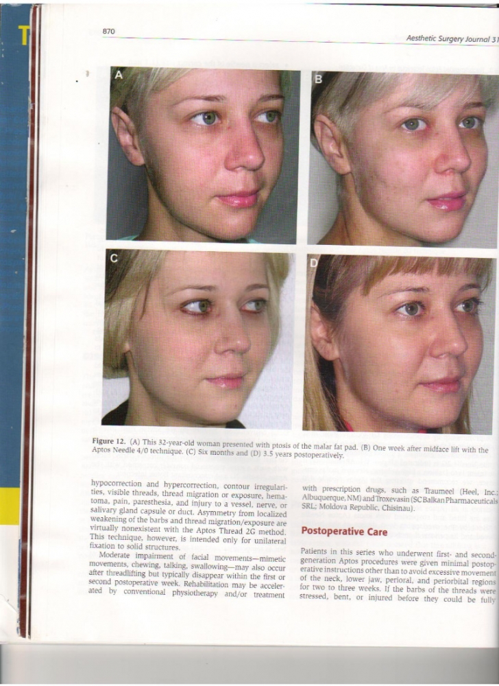 Aesthetic Surgery Journal Volume 31, Issue 8, Nov 2011