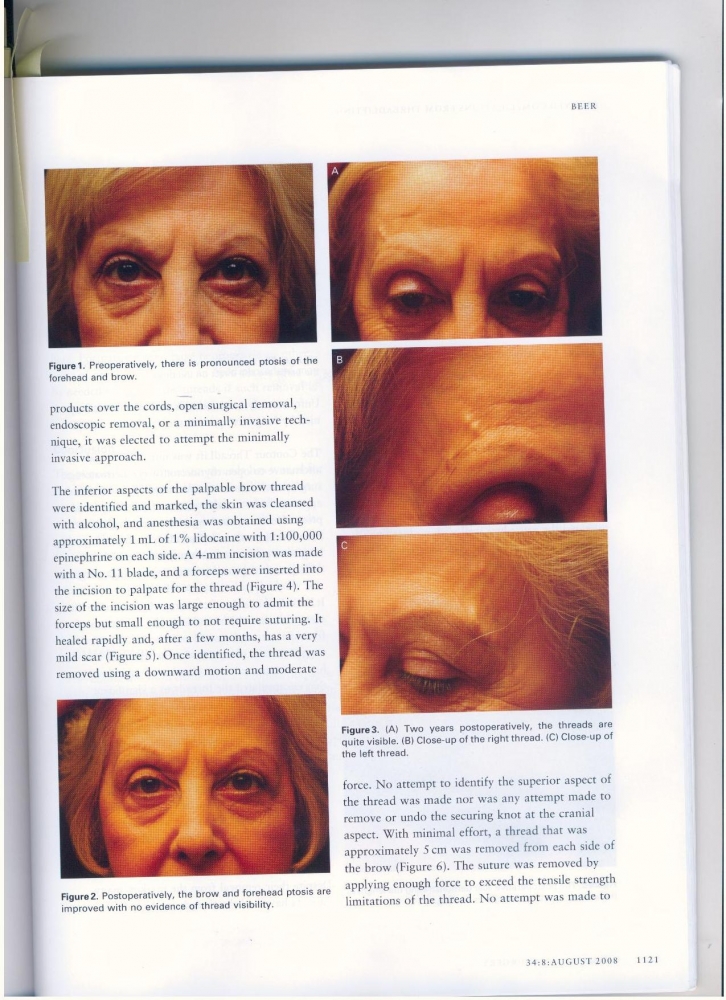 Dermatologic Surgery Volume 34 number 8 August 2008 Dermatologic Surgery Volume 34 number 8 August 2008