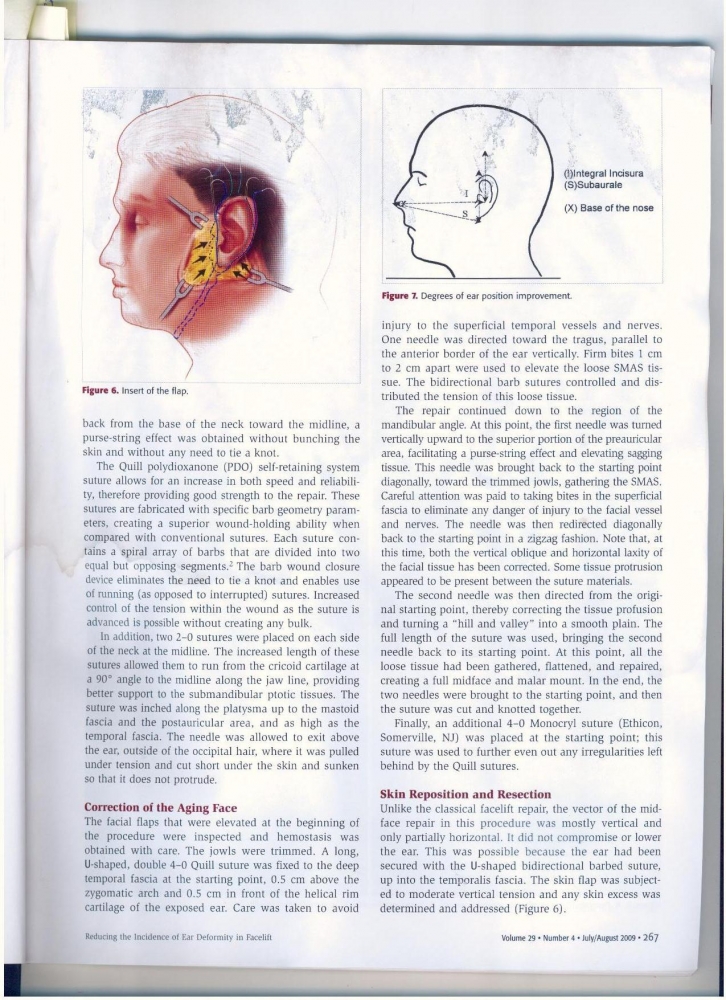 Aesthetic Surgery Journal Volume 29 Issue 4 July -August 2009