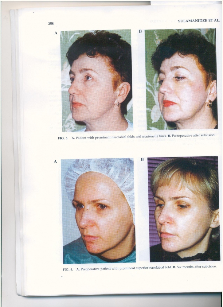 International Journal of Cosmetic Surgery and Aesthetic Dermatology v2, #4, 2000 International Journal of Cosmetic Surgery and Aesthetic Dermatology v2, #4, 2000