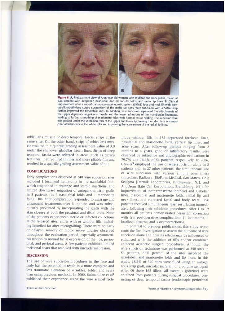 Aesthetic Surgery Journal Volume 28, Issue 6, Nov 2008 Aesthetic Surgery Journal Volume 28, Issue 6, Nov 2008