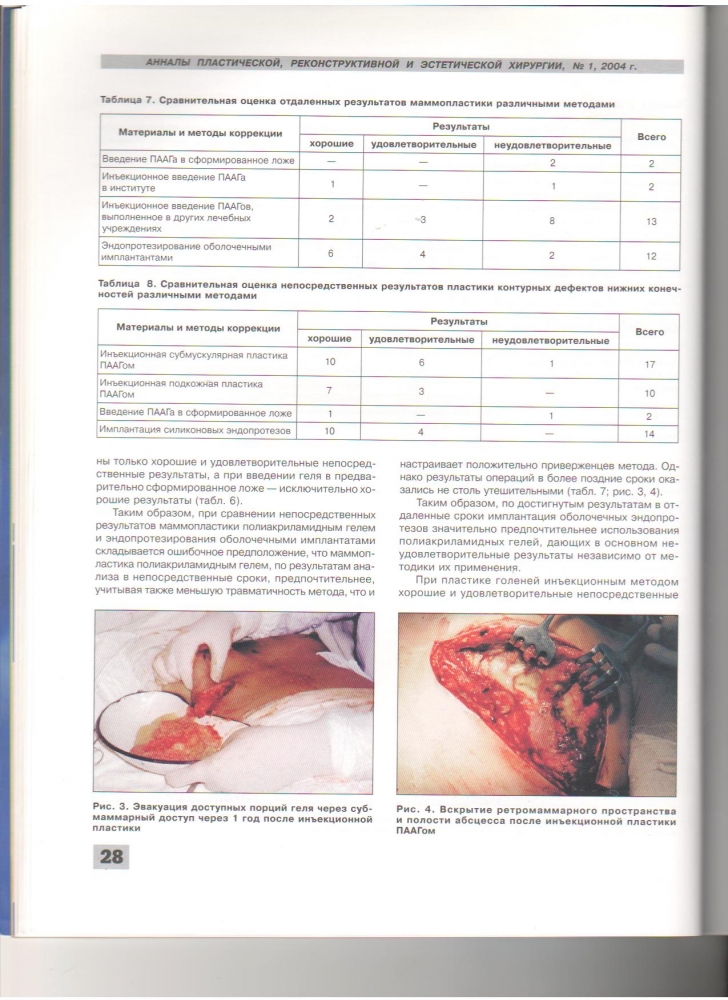 Анналы пластической реконструктивной и эстетической хирургии 1-2004