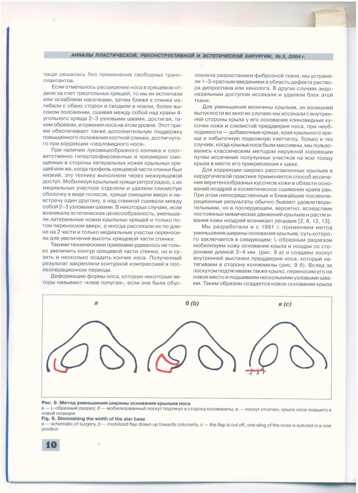 Анналы пластической реконструктивной и эстетической хирургии 3-2004