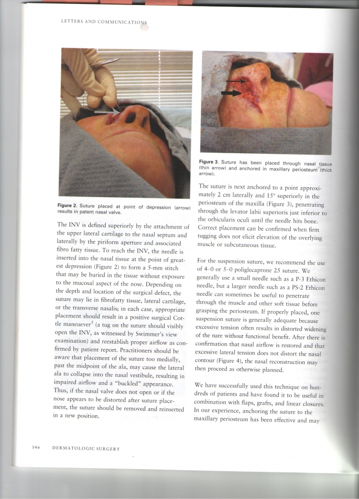 Dermatologic Surgery Volume 40 number 3 Marth 2014