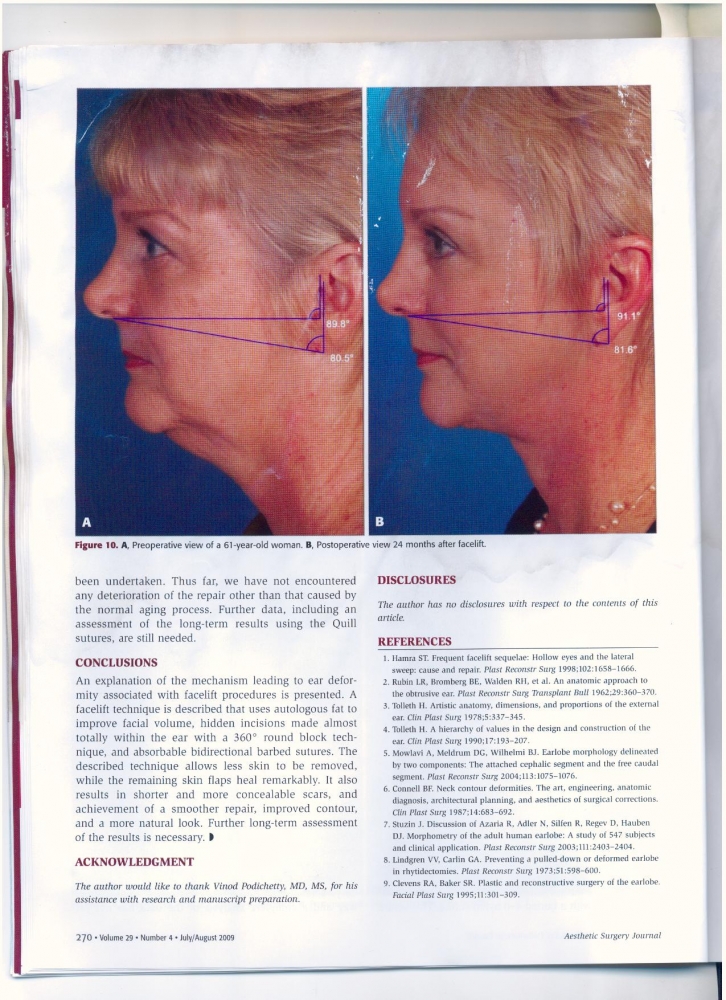 Aesthetic Surgery Journal Volume 29 Issue 4 July -August 2009