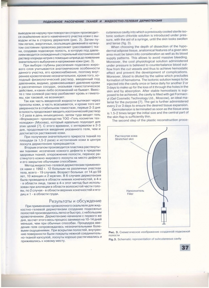 Анналы пластической реконструктивной и эстетической хирургии 2-1997