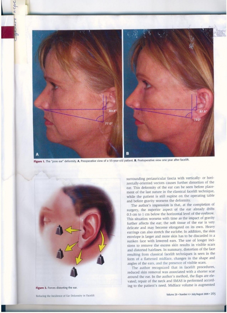 Aesthetic Surgery Journal Volume 29 Issue 4 July -August 2009