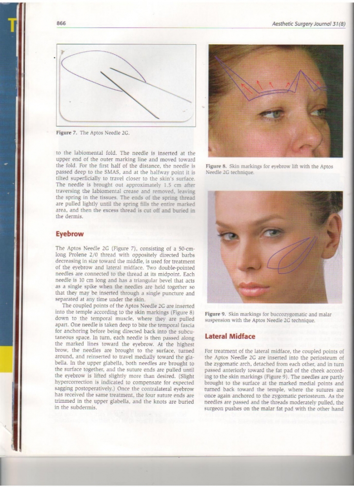 Aesthetic Surgery Journal Volume 31, Issue 8, Nov 2011