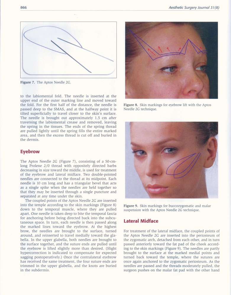 Aesthetic Surgery Journal Volume 31, Issue 8, Nov 2011