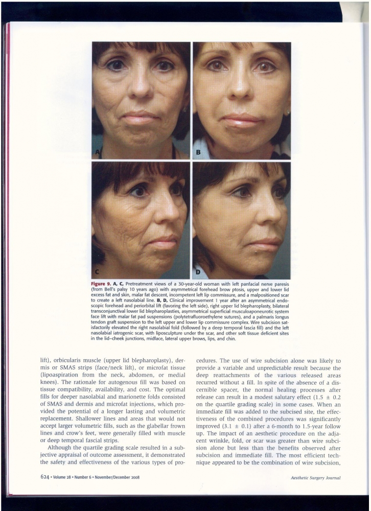 Aesthetic Surgery Journal Volume 28, Issue 6, Nov 2008 Aesthetic Surgery Journal Volume 28, Issue 6, Nov 2008