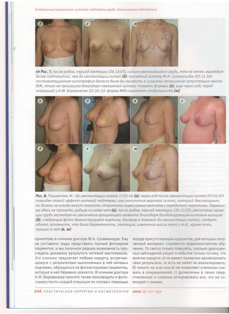 Пластическая хирургия и косметология 2012 (2)
