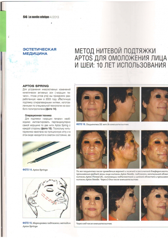 Нувель Эстетик Нувель Эстетик