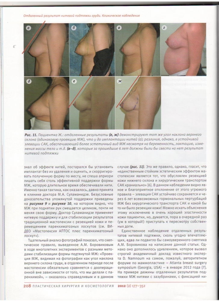 Пластическая хирургия и косметология 2012 (2)