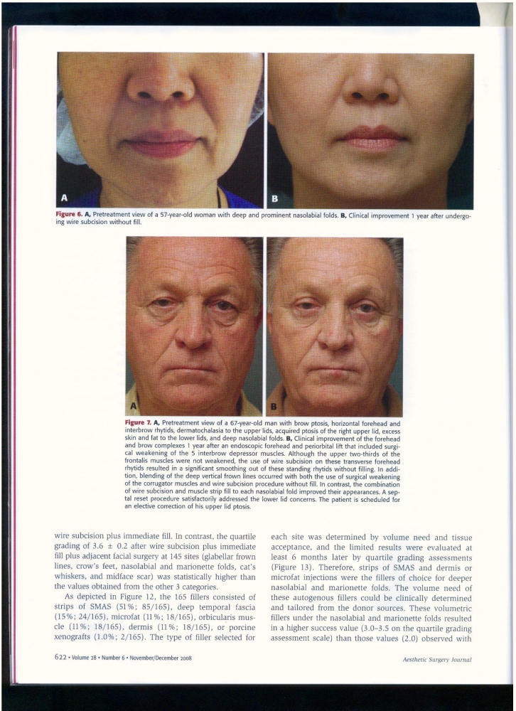 Aesthetic Surgery Journal Volume 28, Issue 6, Nov 2008 Aesthetic Surgery Journal Volume 28, Issue 6, Nov 2008