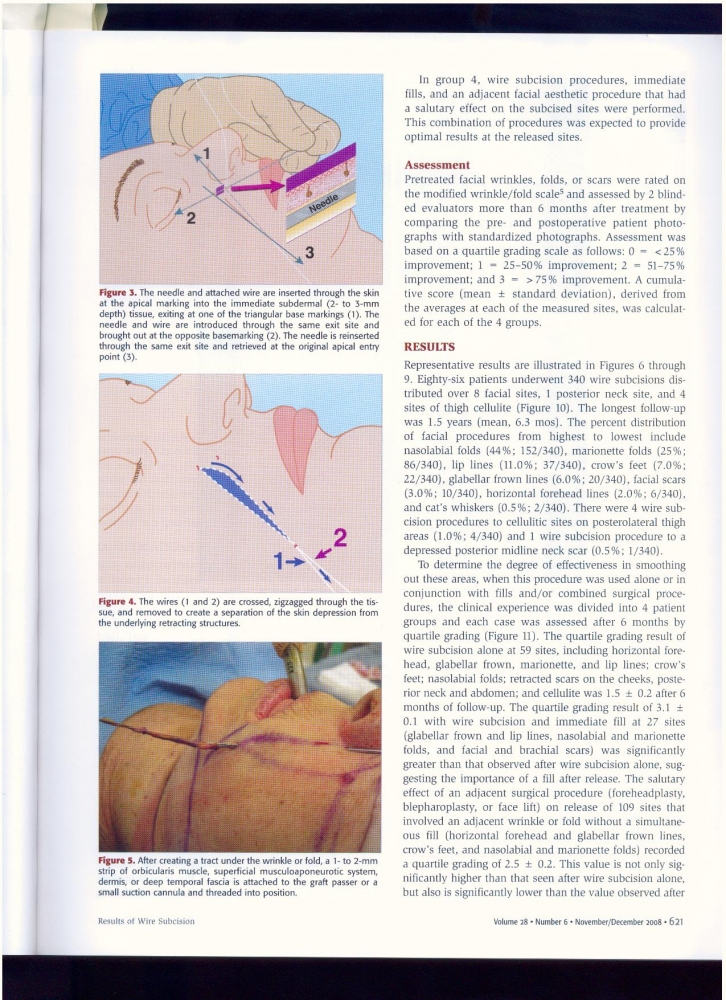 Aesthetic Surgery Journal Volume 28, Issue 6, Nov 2008 Aesthetic Surgery Journal Volume 28, Issue 6, Nov 2008