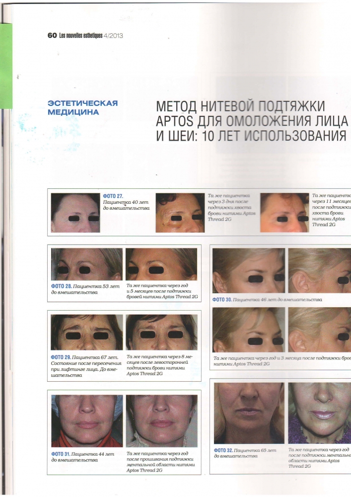 Нувель Эстетик