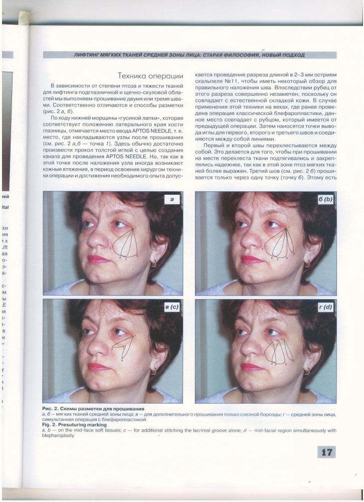Анналы пластической реконструктивной и эстетической хирургии 1-2005