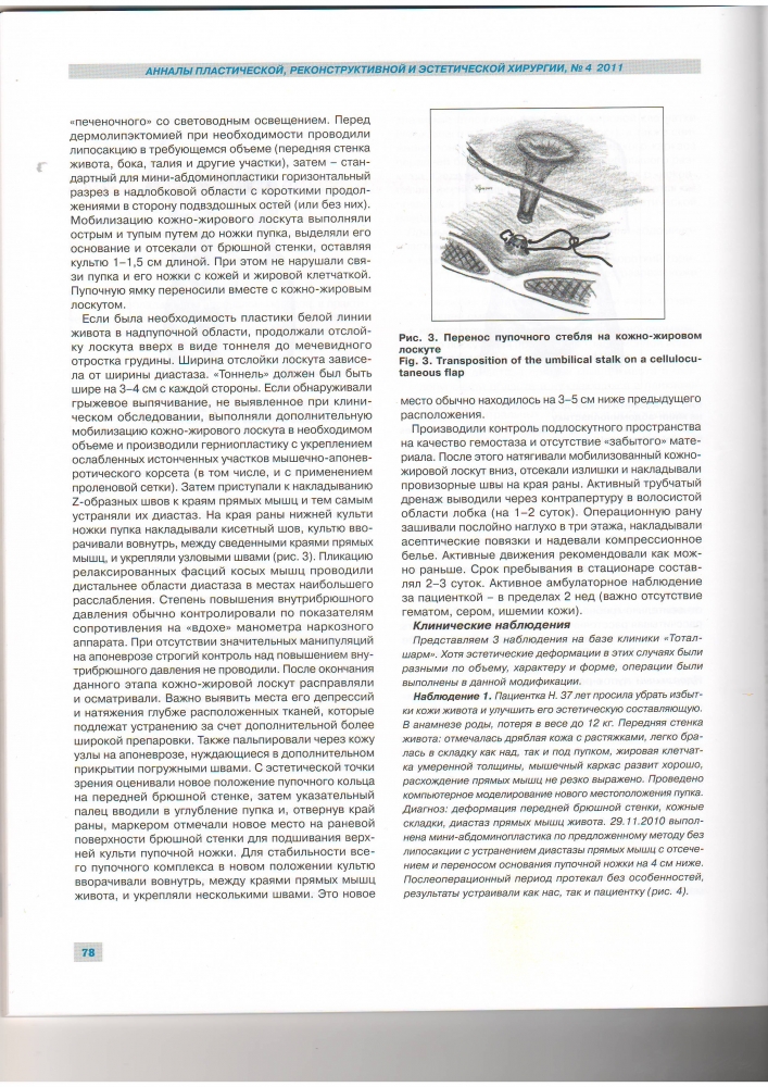 Анналы пластической реконструктивной и эстетической хирургии 4-2011