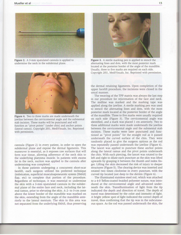 Aesthetic Surgery Journal Volume 32, Issue 1, Jan 2012 Aesthetic Surgery Journal Volume 32, Issue 1, Jan 2012