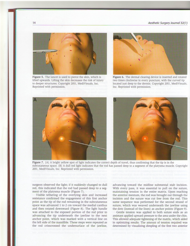 Aesthetic Surgery Journal Volume 32, Issue 1, Jan 2012