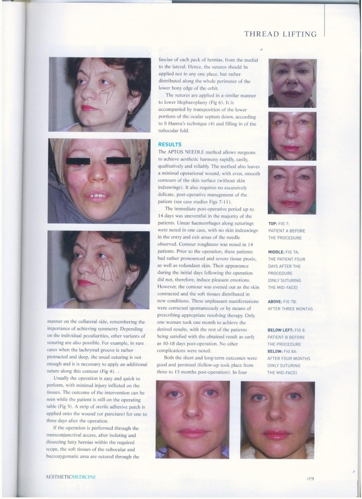 Aesthetic Medicine nov 2006