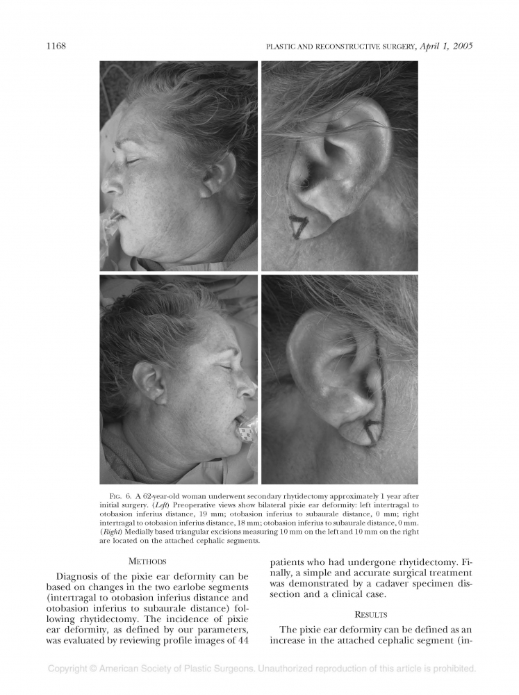 Plastic and reconstructive surgery Volume 118 number 2 Aug 2006 Plastic and reconstructive surgery Volume 118 number 2 Aug 2006