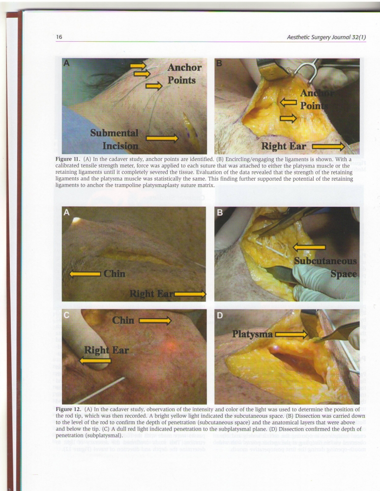 Aesthetic Surgery Journal Volume 32, Issue 1, Jan 2012