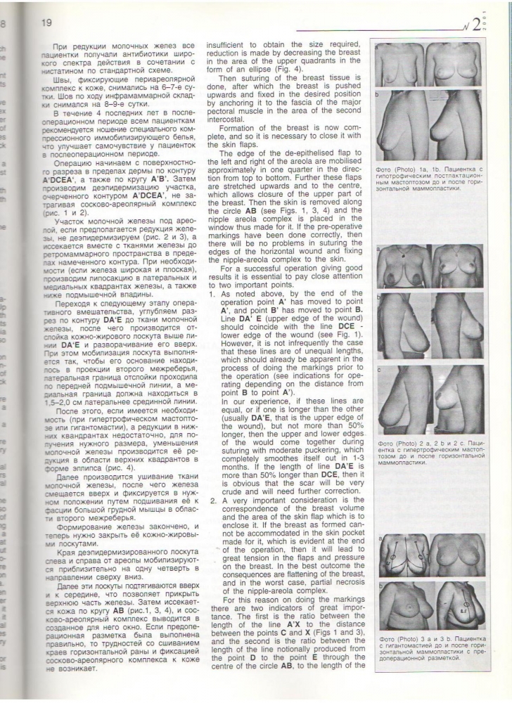HERALD №2/2001 Горизонт. Маммапластика HERALD №2/2001 Горизонт. Маммапластика
