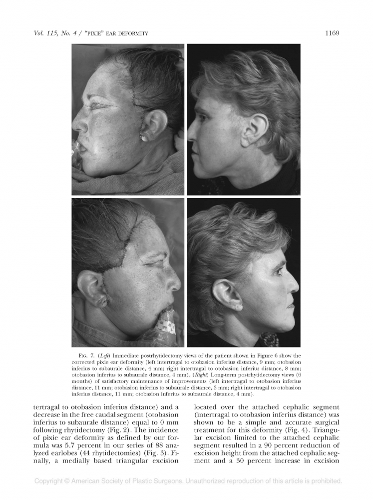 Plastic and reconstructive surgery Volume 118 number 2 Aug 2006