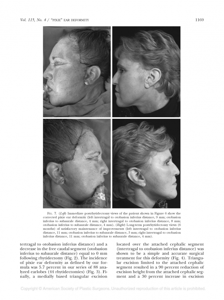 Plastic and reconstructive surgery Volume 118 number 2 Aug 2006 Plastic and reconstructive surgery Volume 118 number 2 Aug 2006