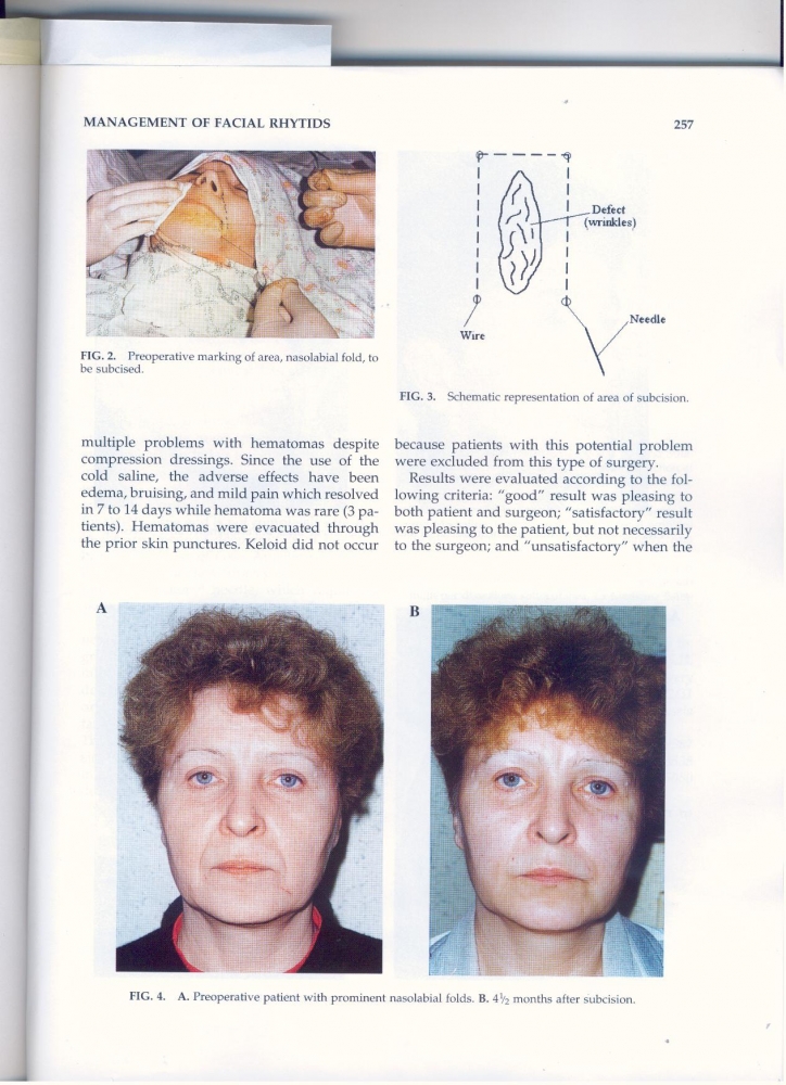 International Journal of Cosmetic Surgery and Aesthetic Dermatology v2, #4, 2000 International Journal of Cosmetic Surgery and Aesthetic Dermatology v2, #4, 2000