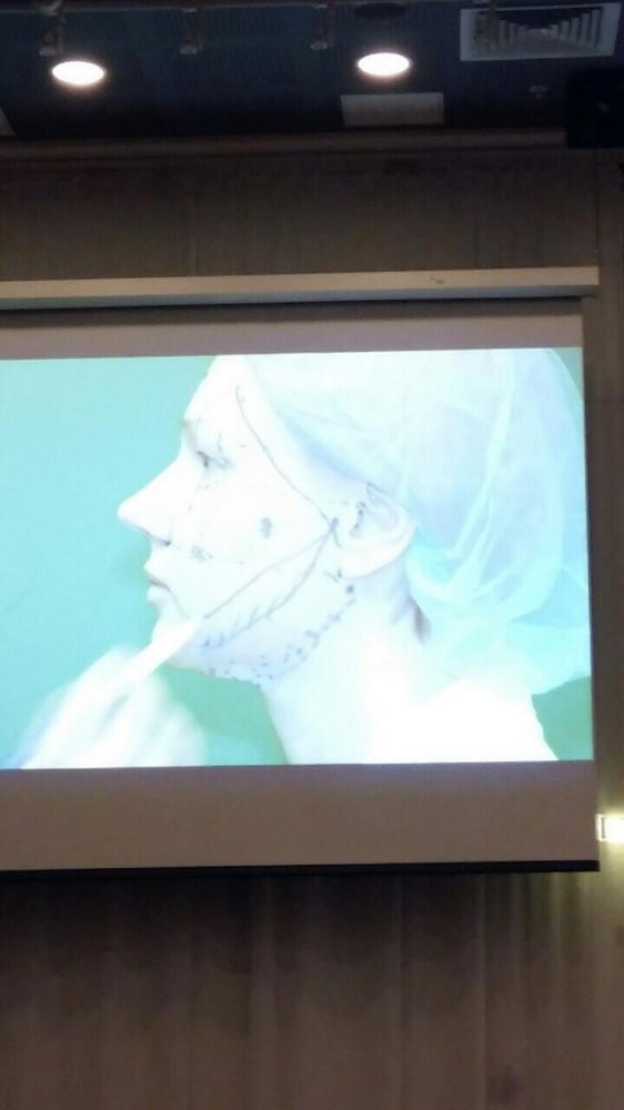 APTOS в Санкт-Петербурге: онлайн-операции по омоложению лица APTOS в Санкт-Петербурге: онлайн-операции по омоложению лица