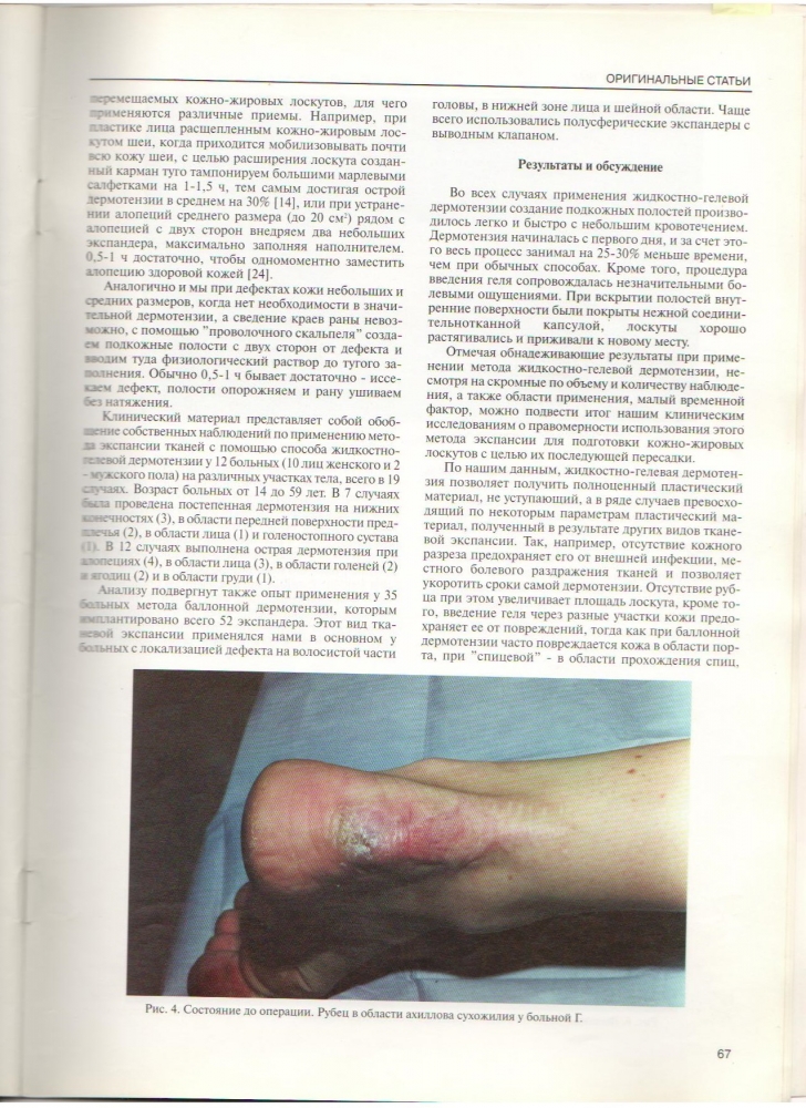 Анналы хирургии, №2 / 1997