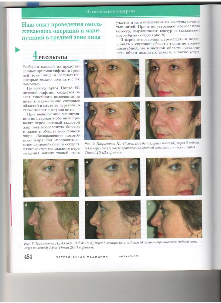 Эстетическая медицина 10-3-2011 Эстетическая медицина 10-3-2011