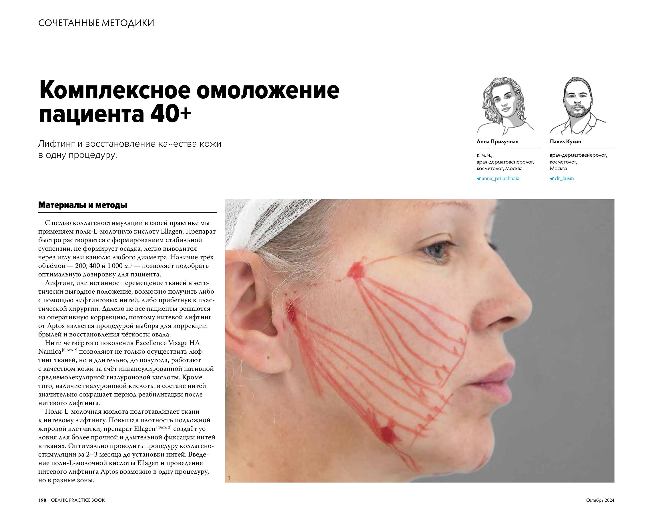 Облик Аптос_file-2.jpg