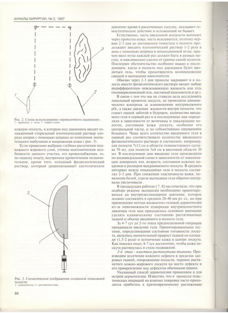 Анналы хирургии, №2 / 1997