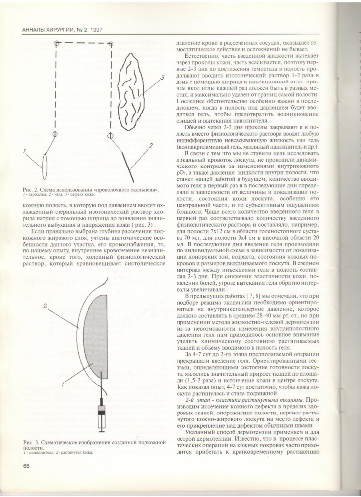 Анналы хирургии, №2 / 1997 Анналы хирургии, №2 / 1997