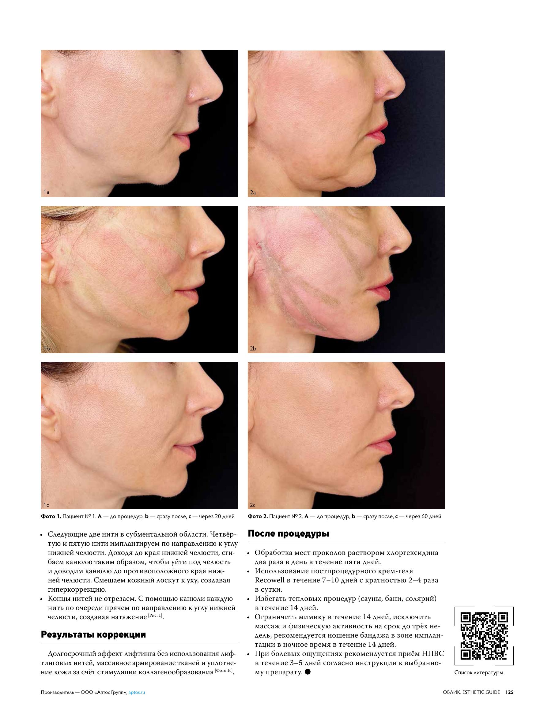 Облик Аптос_file-4.jpg