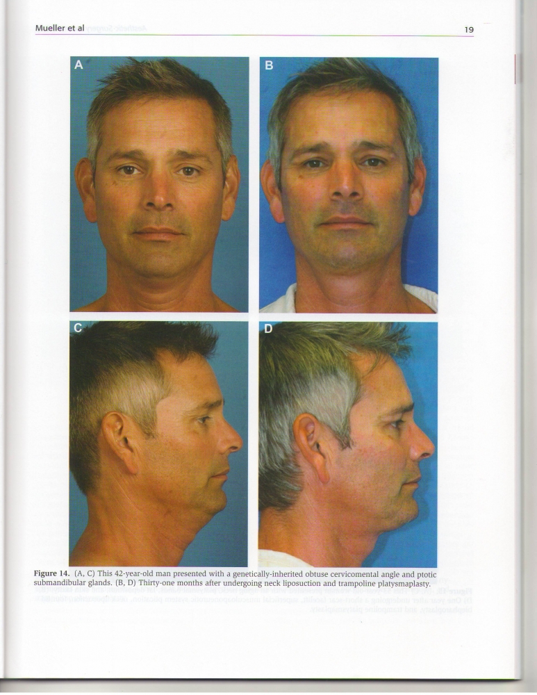 Aesthetic Surgery Journal Volume 32, Issue 1, Jan 2012 Aesthetic Surgery Journal Volume 32, Issue 1, Jan 2012